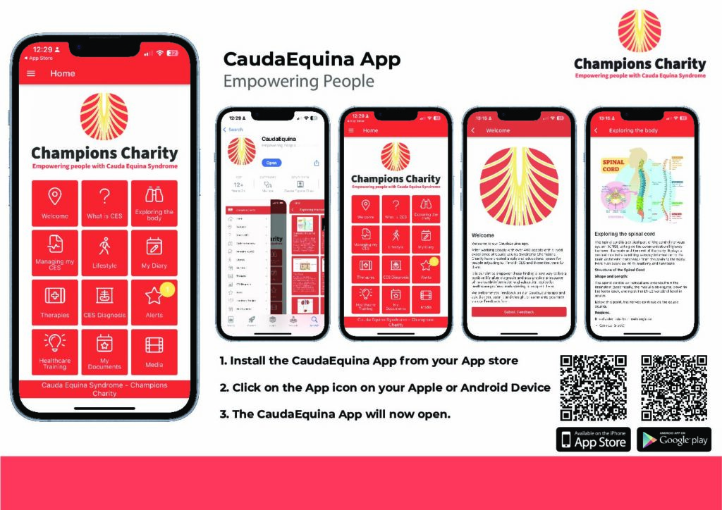 From Experience to Innovation: Why We Created the CaudaEquina App